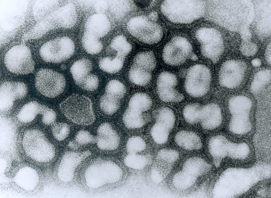 Influenza A virus, the virus that causes Avian flu.