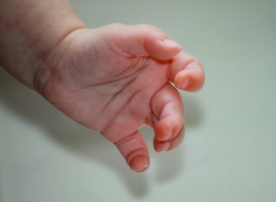 A baby, about to clench its fist at the crushing injustice of it all